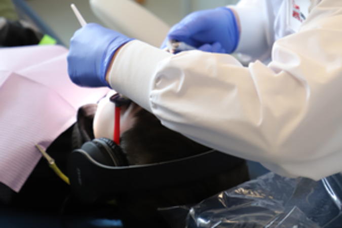 A dentist restoring a damaged tooth with a dental filling.